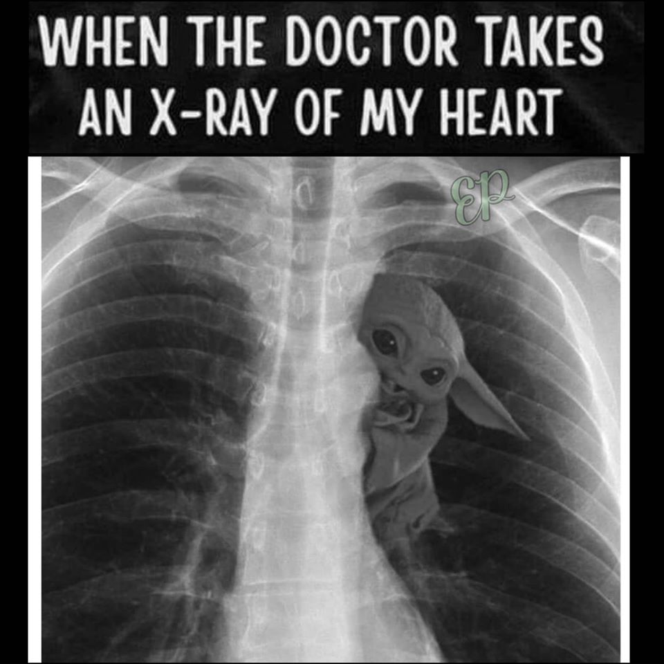 This meme is a play on a common medical phrase "When you don't see a doctor for a long time" and features an x-ray image of a person's chest with a surprise inside. The image is captioned "When the doctor takes an x-ray of your heart" and shows a small, cartoon-like character ( likely a reference to the character from the movie "Star Wars") emerging from the heart. The character is likely a nod to the popular "I see you" meme, but in this case, it's a playful and humorous take on a medical procedure.